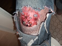 Disgusting knee wound